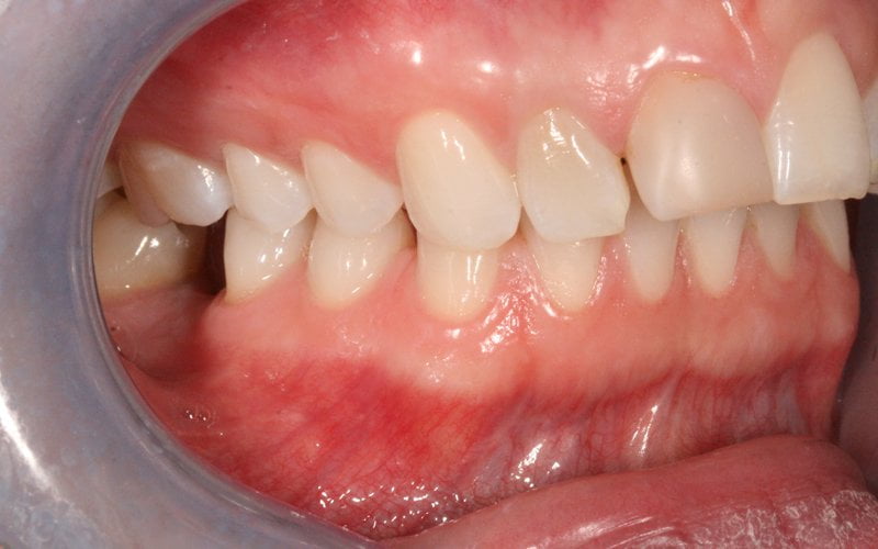 clovery dental